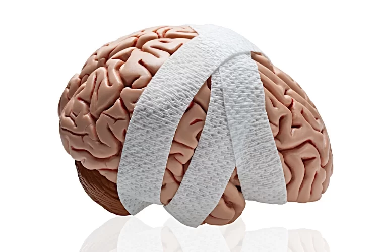 علائم ضربه مغزی چیست؟ | آیا ضربه مغزی درمان میشود؟