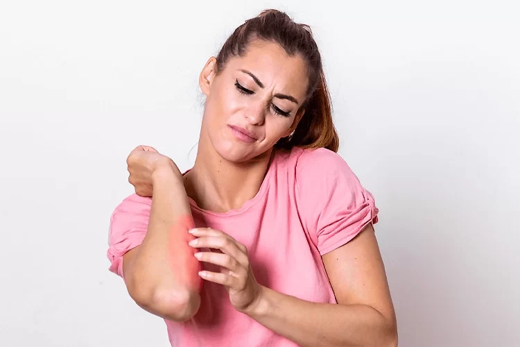 کاردرمانی پس از سوختگی | تاثیر شگفت انگیز کاردرمانی بر کاهش عوارض سوختگی