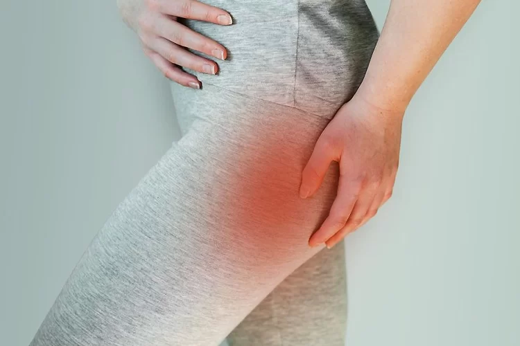 سندروم پیریفورمیس چیست؟ | درمان کامل سندروم پیریفورمیس با کاردرمانی