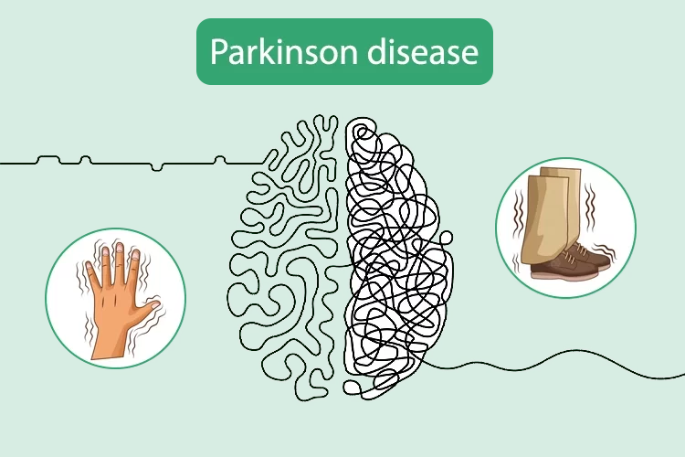 علائم حرکتی بیماری پارکینسون | جلوگیری از پیشرفت پارکینسون با کاردرمانی