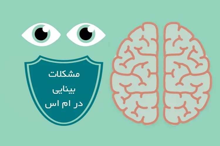 مشکلات بینایی در ام اس | ام اس چه اثراتی بر روی چشم میگذارد؟