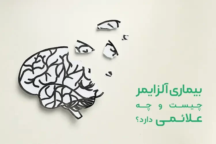 بیماری آلزایمر (Alzheimer) چیست و چه علائمی دارد؟