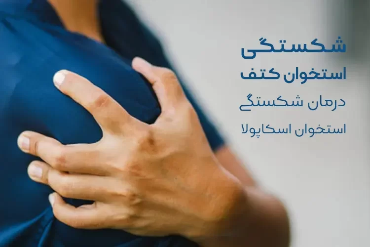 شکستگی استخوان کتف | درمان شکستگی استخوان اسکاپولا