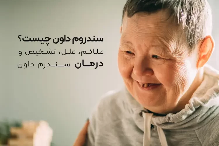سندروم داون (Down Syndrome) چیست؟ | علائم، علل، تشخیص و درمان سندروم داون