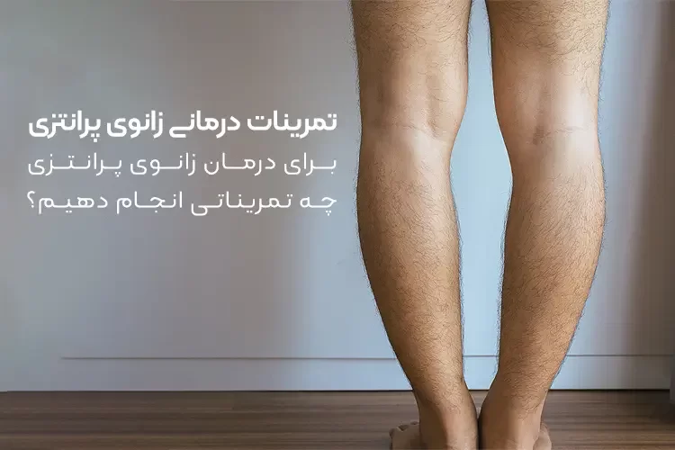 تمرینات درمانی زانوی پرانتزی | برای درمان زانوی پرانتزی چه تمریناتی انجام دهیم؟