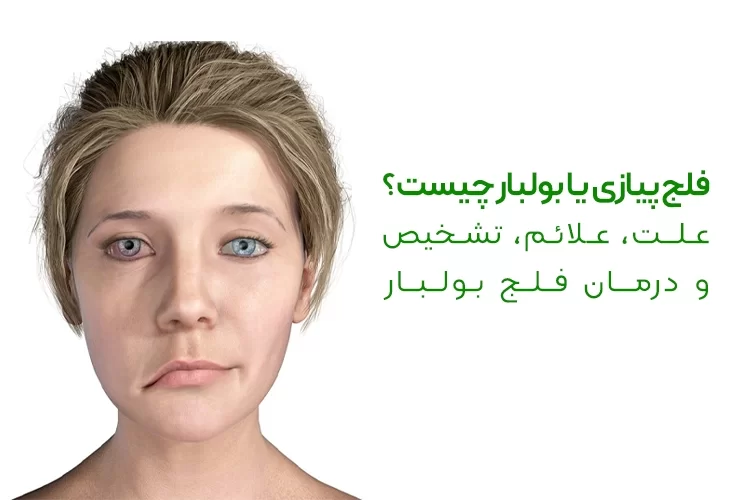 فلج پیازی یا بولبار چیست؟ | علت، علائم، تشخیص و درمان فلج بولبار