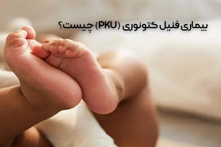 بیماری فنیل کتونوری (PKU) چیست؟