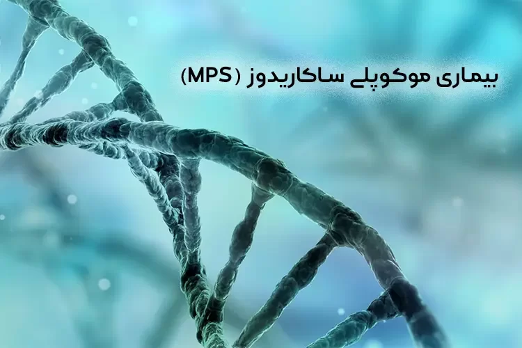 بیماری موکوپلی ساکاریدوز (MPS) چیست؟