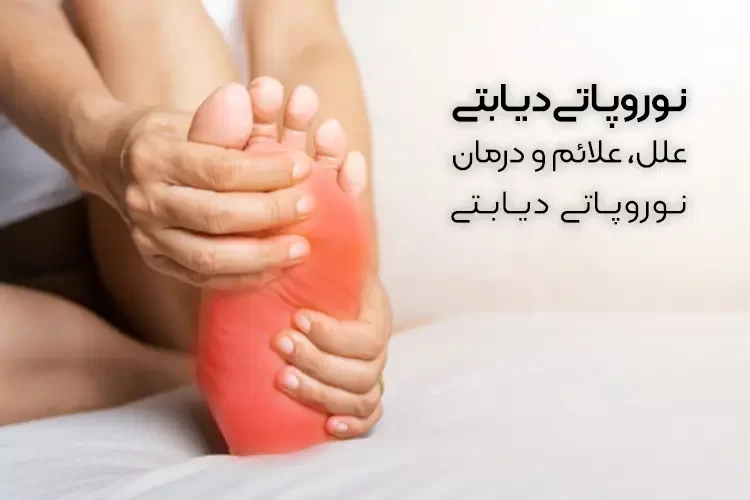 نوروپاتی دیابتی چیست؟ | علل، علائم و درمان نوروپاتی دیابتی