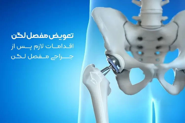 تعویض مفصل لگن | اقدامات لازم پس از جراحی مفصل لگن